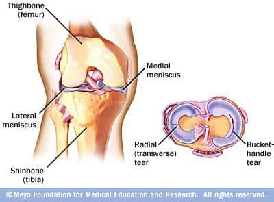 Are Popping and Cracking? Sheffield Physiotherapy